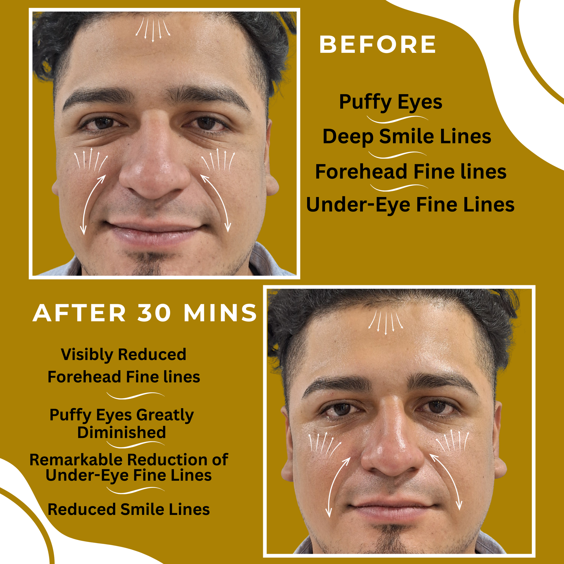 Anti-Aging Serum