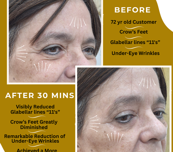 Anti-Aging Serum