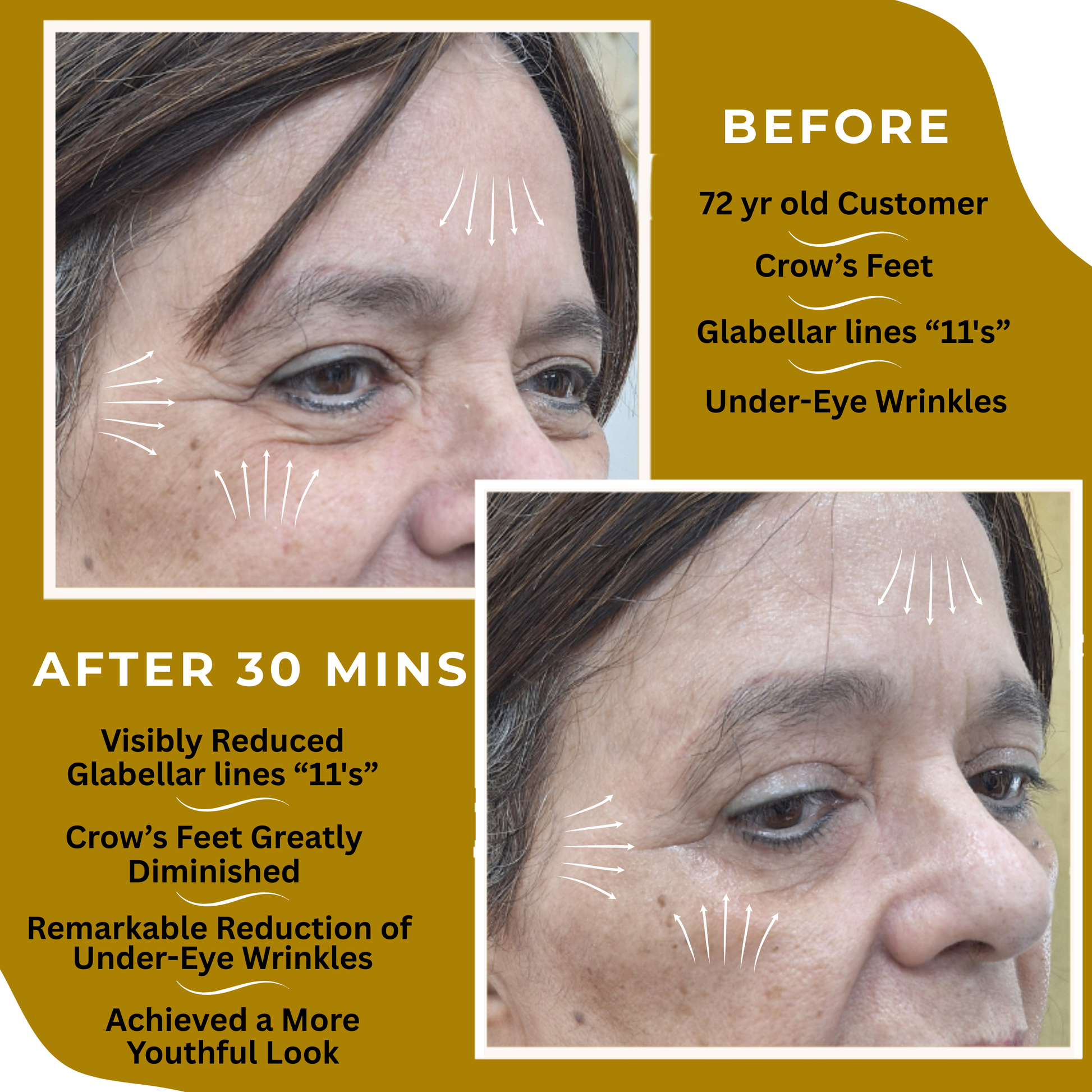 Anti-Aging Serum